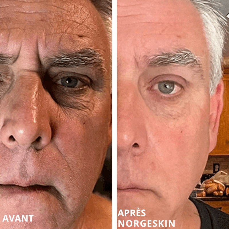 NORGESKIN® - Baume Anti-Âge Hydratant