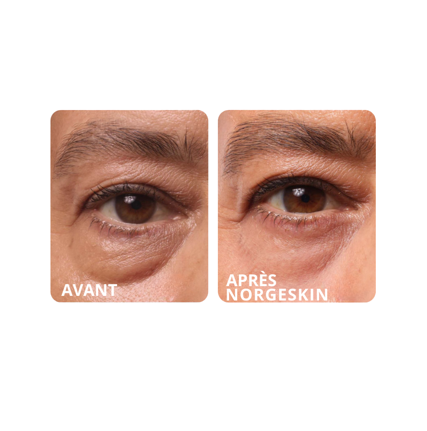 NORGESKIN® - Baume Anti-Âge Hydratant